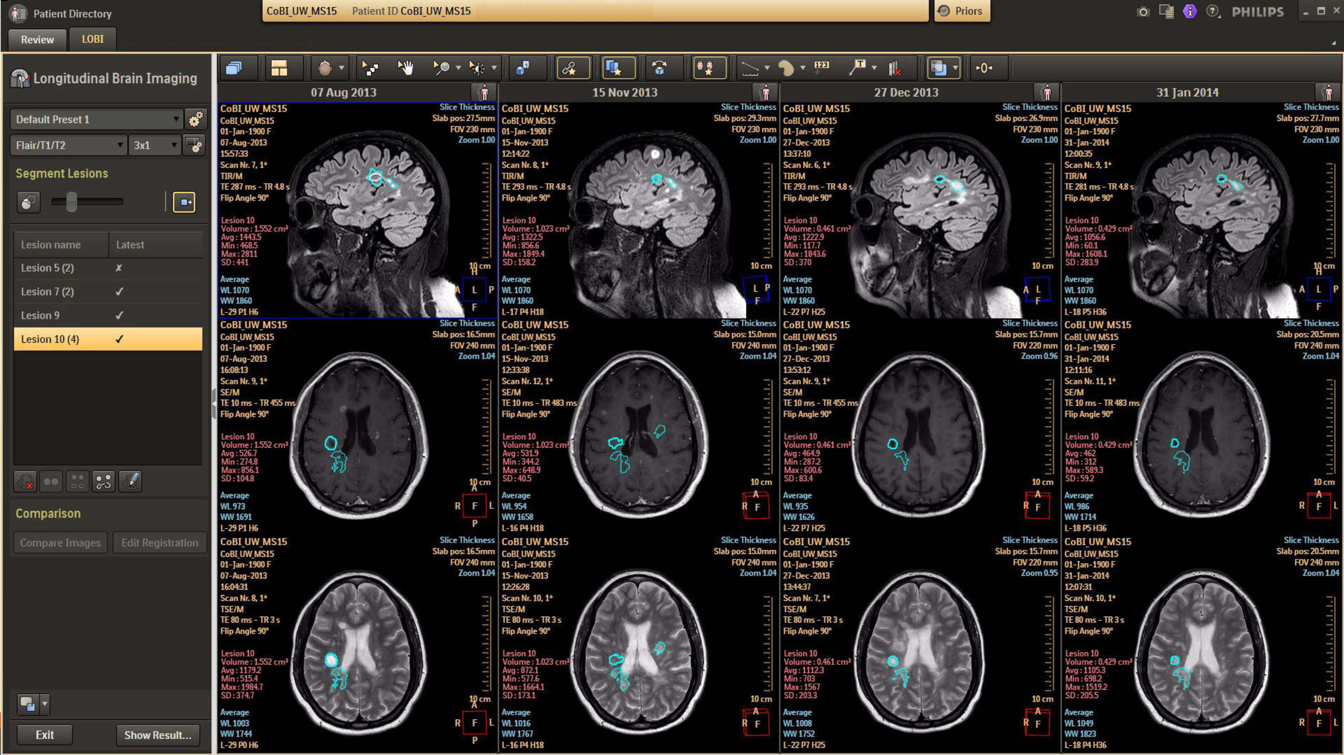 Brain imaging