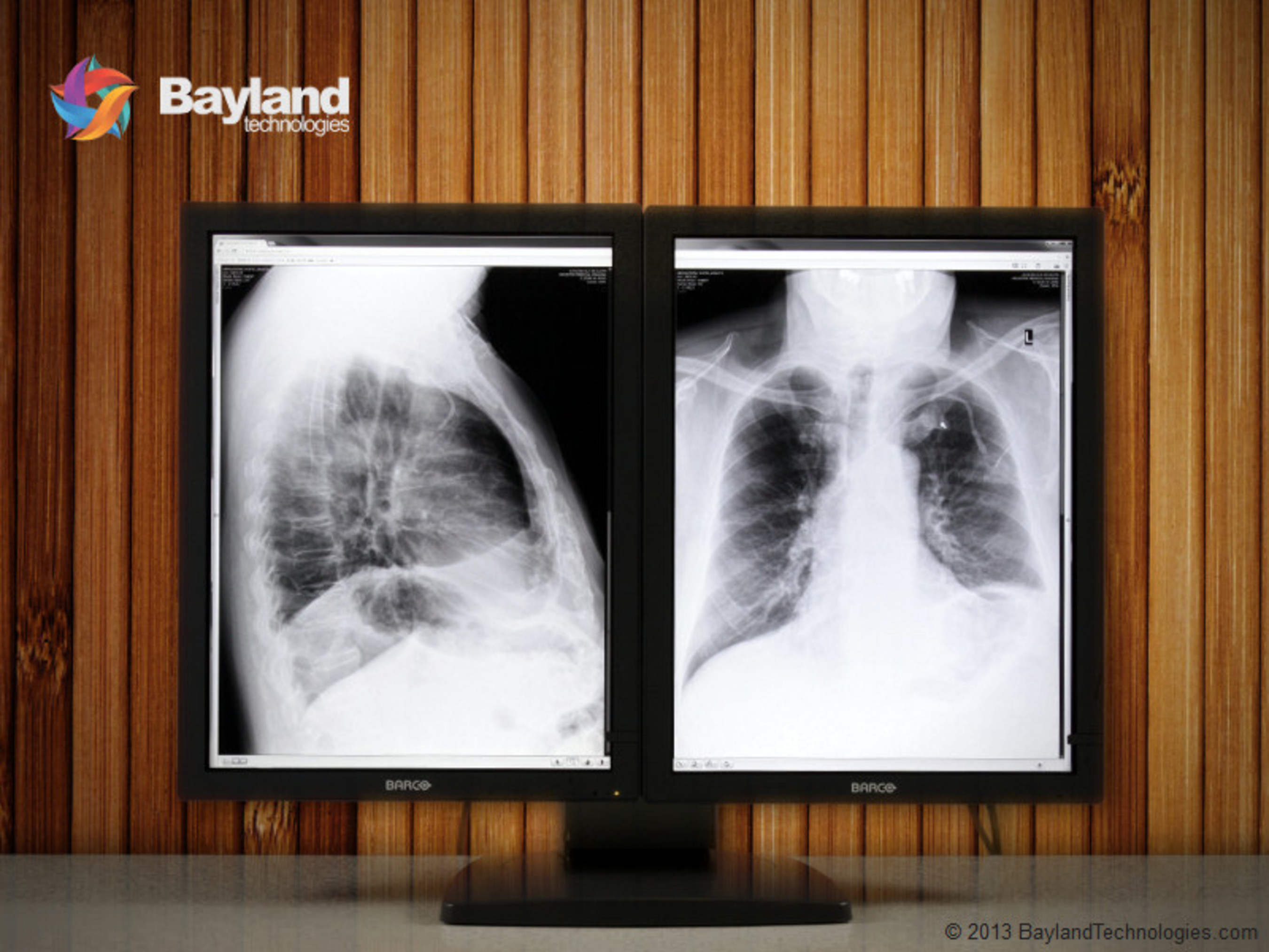 Radiograph Reader For Mac