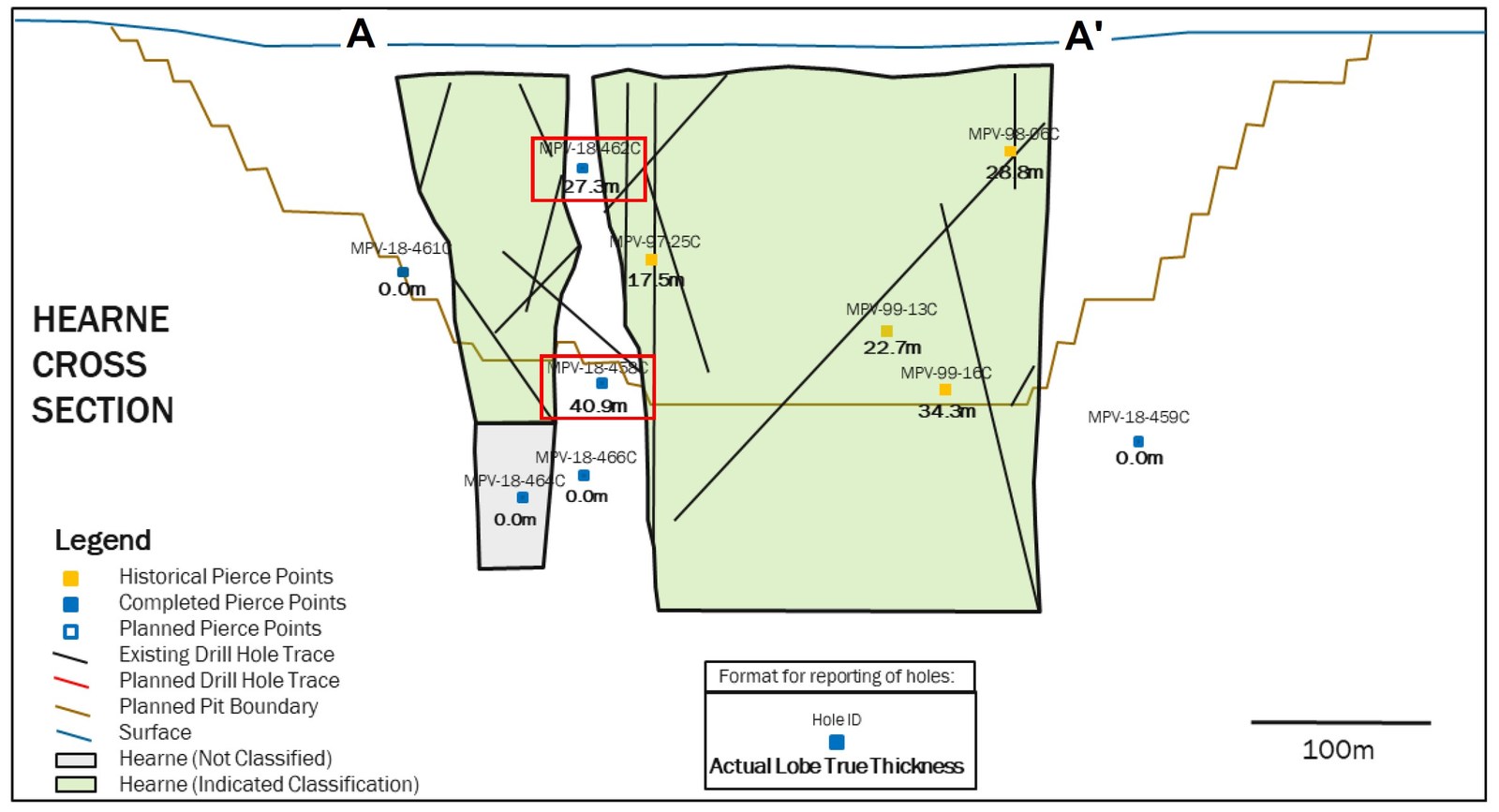 Figure 3: Cross section of drilling completed at Hearne, oriented on A-A' line as indicated in Figure 2. Pierce points of kimberlite granite breccia intercepts are highlighted in red.