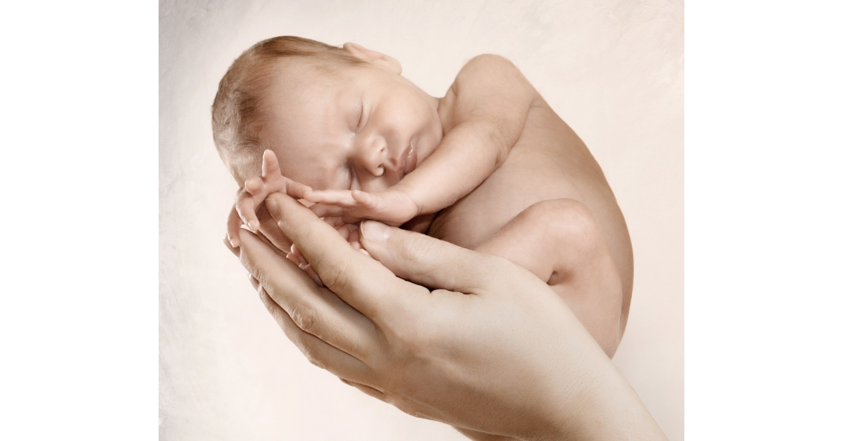 Новорожденные с патологиями. Родился вперед руками. Новорожденный ребенок. Ребёнок 14 дней. Родился вперед руками.