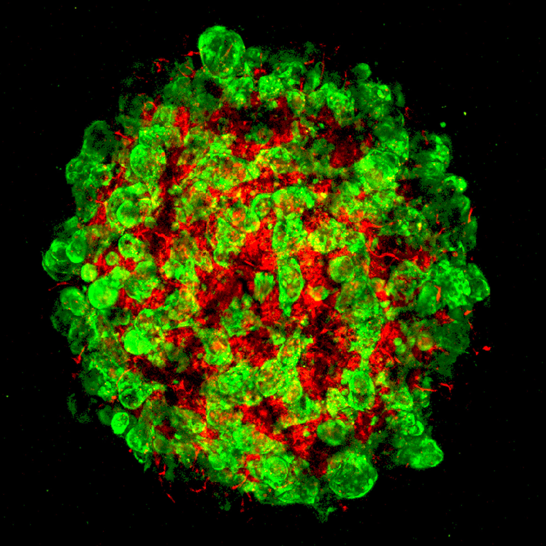 Стволовые клетки печени. Печеночно-клеточная аденома. Зелёная печень фитонциды. Pluripotent Stem Cells image.